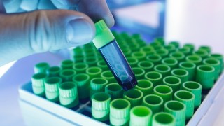 多家上市公司回应“万能神药”，有产品紧急下架！国内已注册数百个临床试验