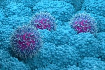 Revolution Medicines胰腺癌药物在晚期试验中获得成功